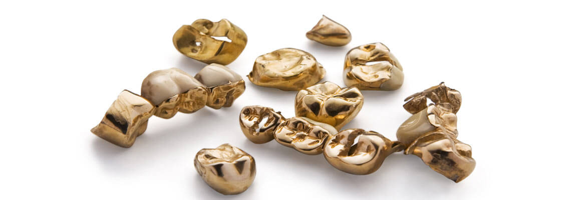 Goldverkauf in in Andernach